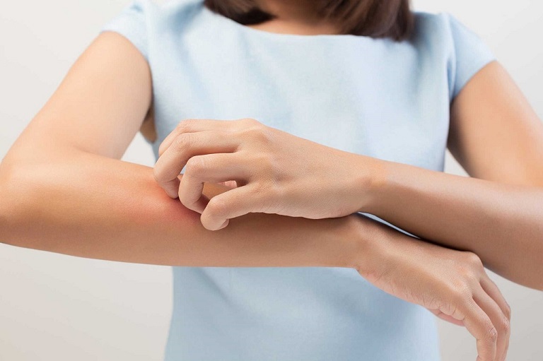 Bệnh dị ứng thời tiết