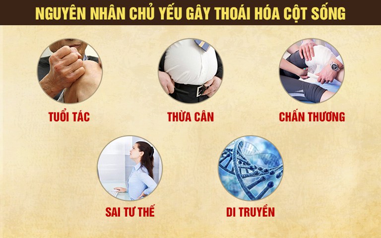 Nguyên nhân gây ra thoái hóa