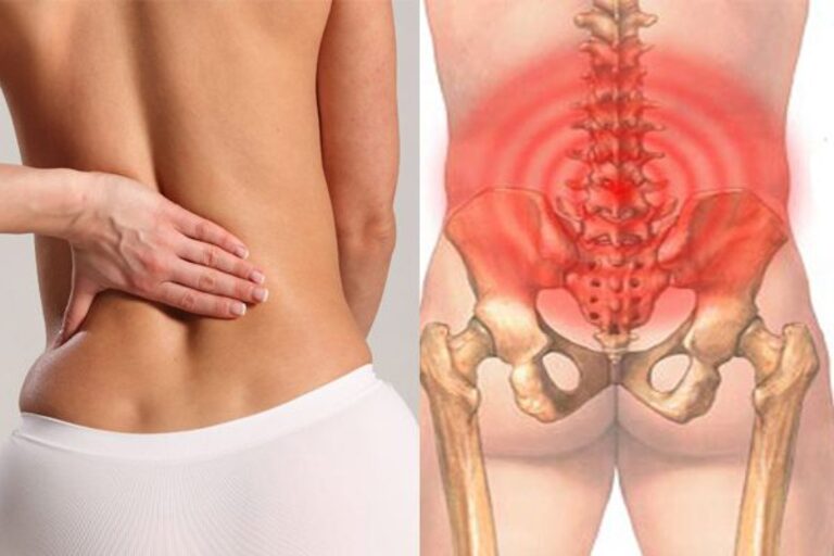 Tình trạng đau lưng thường xuất phát từ cột sống