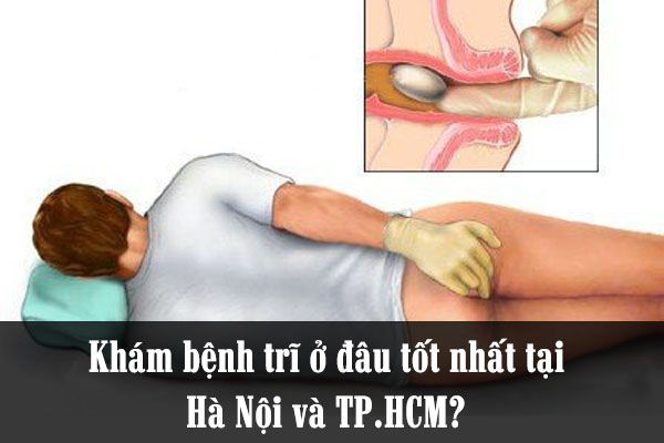 Khám bệnh trĩ ở đâu tốt nhất tại HN và TP.HCM. Dưới đây là những gợi ý dành cho bạn