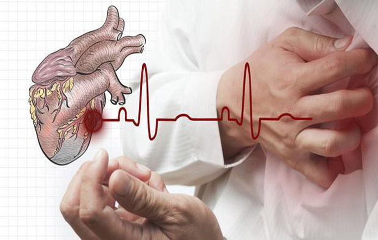 Những người bị bệnh tim mạch không nên dùng tỏi chữa viêm xoang