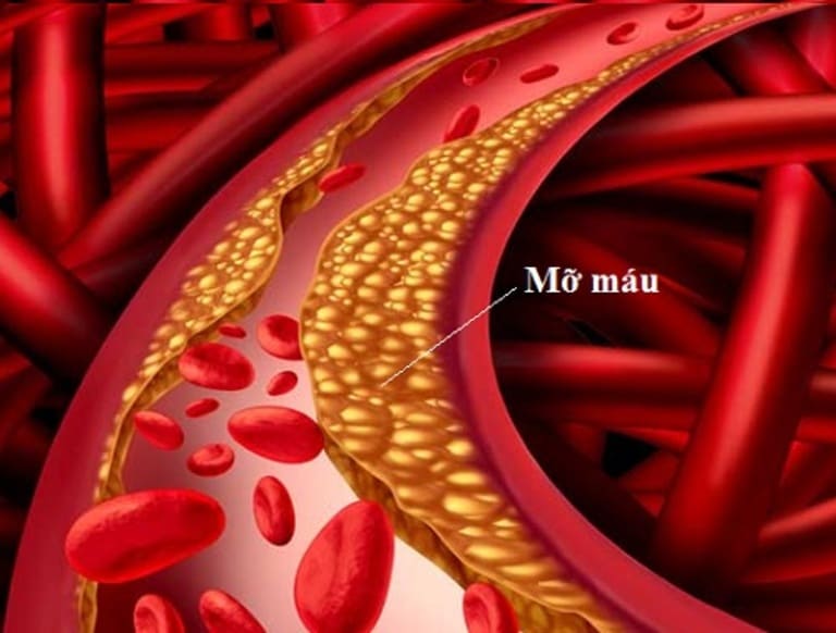 Liệt dương liên quan nhiều đến quá trình lưu thông máu đến dương vật