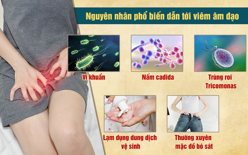 Những nguyên nhân phổ biến dẫn tới viêm âm đạo