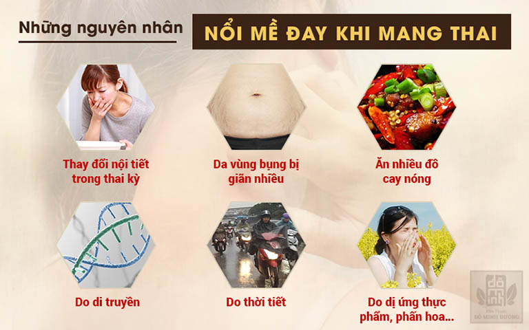 Nguyên nhân gây nổi mề đay khi mang thai 3 tháng cuối