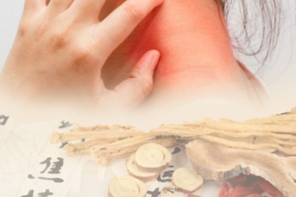 Viêm da cơ địa có lây không?