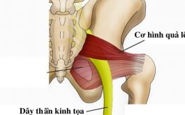 Vị trí của cơ tháp bắt chéo qua dây thần kinh tọa. Luyện tập cơ này có thể giảm được tình trạng đau nhức.