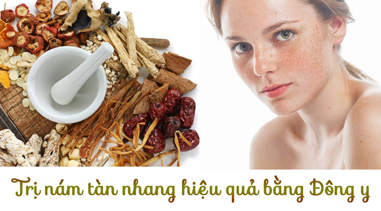 Bài thuốc Đông y trị nám tàn nhang
