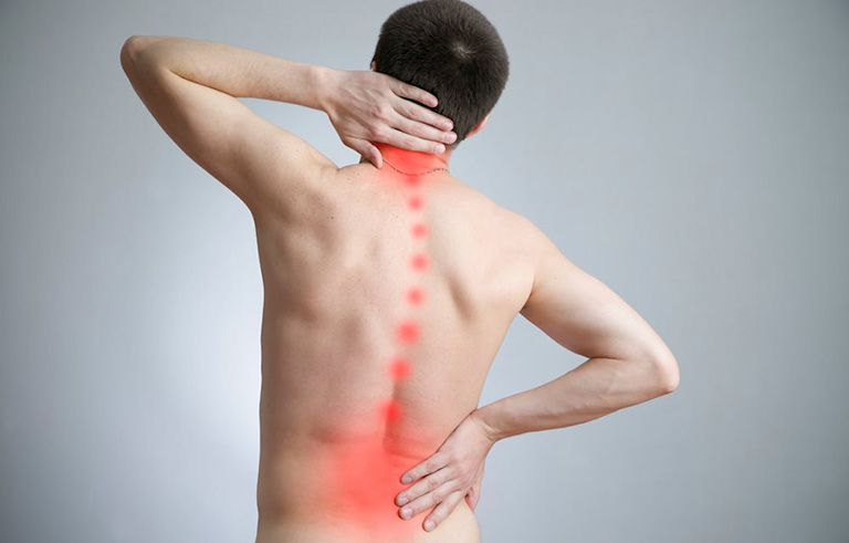 Nguyên nhân bệnh đau lưng 