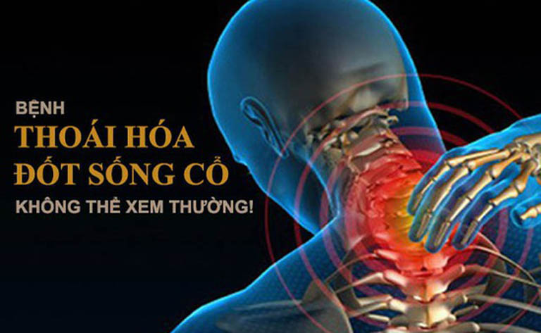 Thoái hóa đốt sống cổ