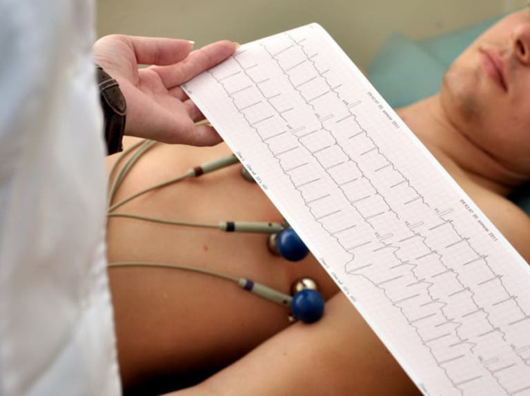 Biến chứng liên quan đến tim khá thường gặp ở người bị viêm khớp dạng thấp. Do đó, đo điện tâm đồ sẽ giúp bác sĩ xác định bệnh đã chuyển nặng hay chưa.