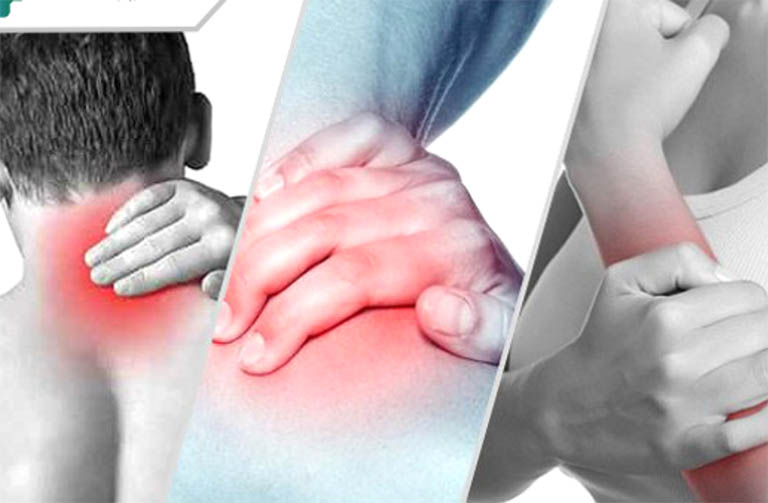 Hội chứng cổ vai cánh tay và các phương pháp điều trị