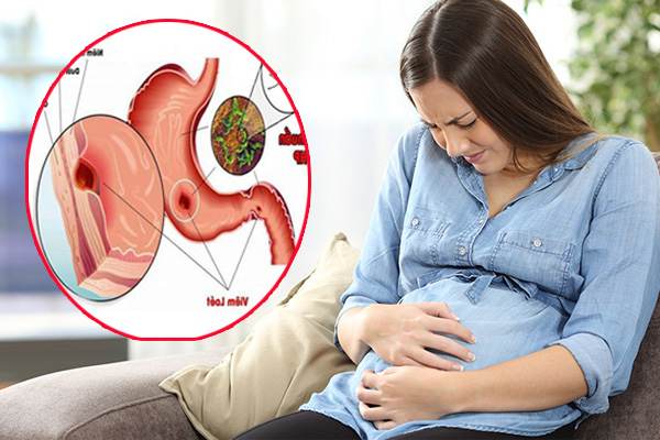 Đau dạ dày khi mang thai có những triệu chứn nào?