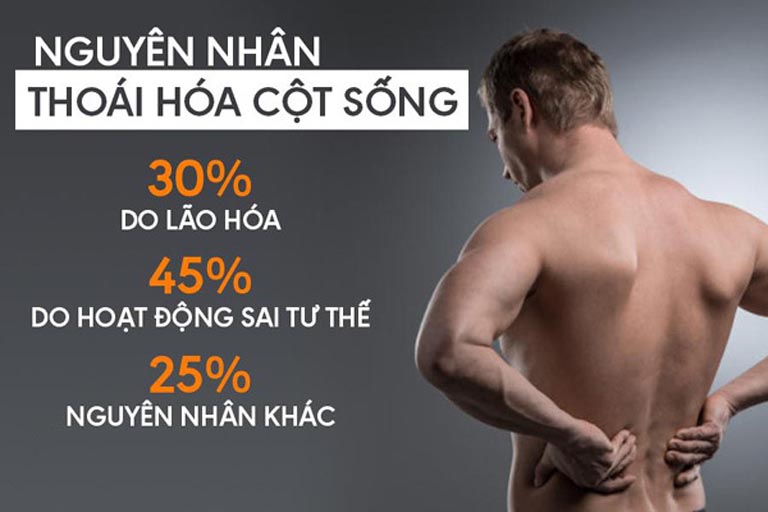 Nguyên nhân thoái hóa cột sống cổ