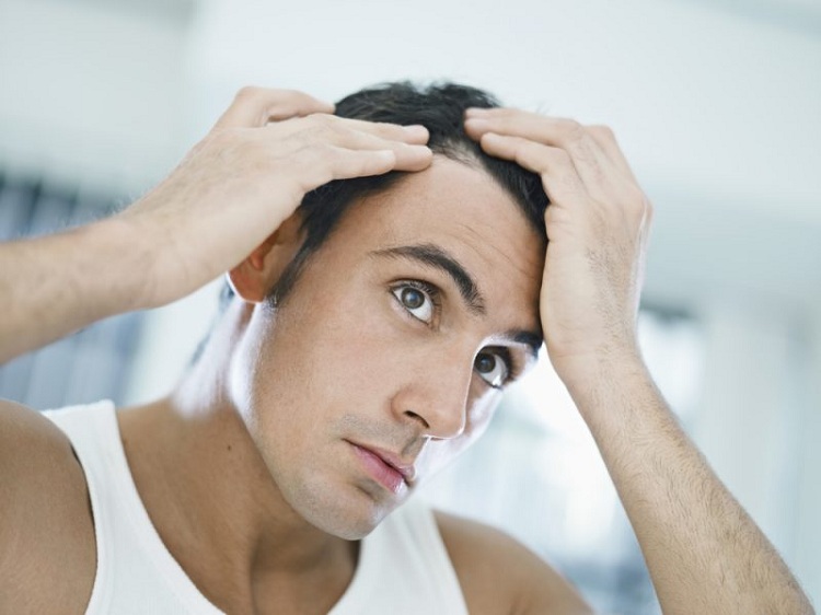 Nam giới tóc rụng nhiều do suy giảm Testosterone trong cơ thể