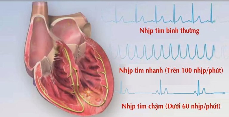 Tác dụng phụ của Berberin ảnh hưởng nhiều đến hoạt động của tim. Và vì thế, nó rất dễ dẫn đến tử vong.