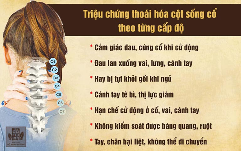 Triệu chứng thoái hóa đốt sống cổ