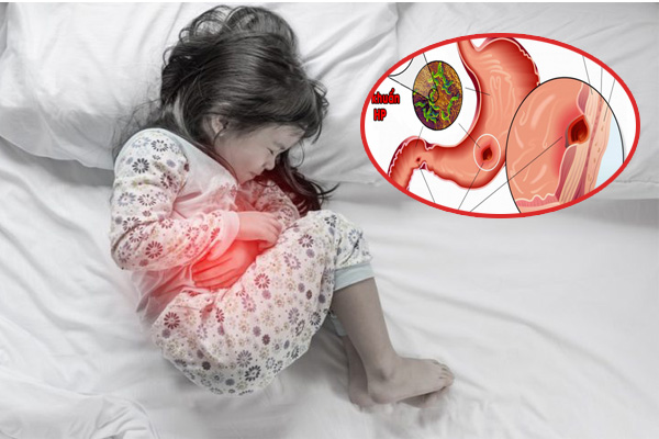 Cảnh báo triệu chứng đau dạ dày ở trẻ nhỏ