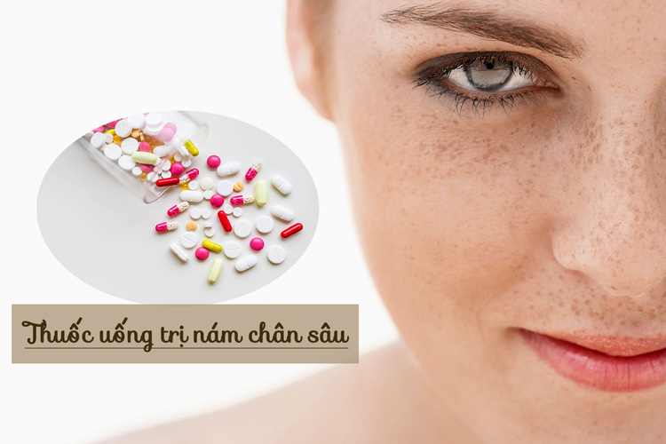 Thuốc uống trị nám chân sâu