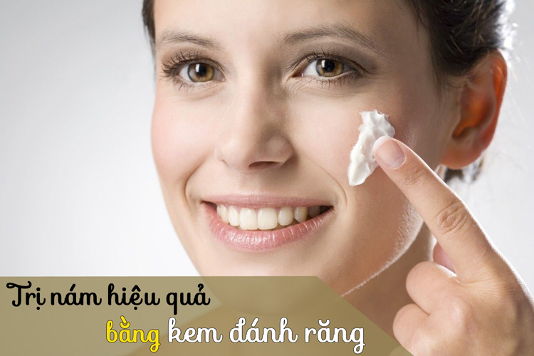 Trị nám bằng kem đánh răng