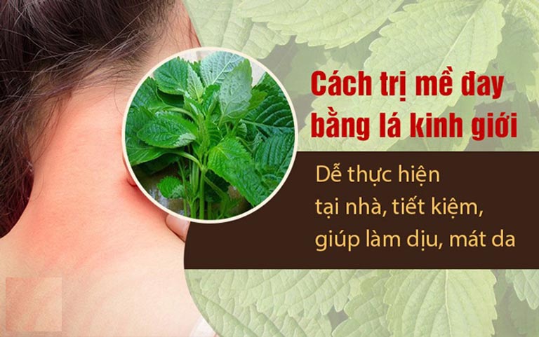 Dùng lá kinh giới trị ngứa da nổi mẩn đỏ an toàn, lành tính