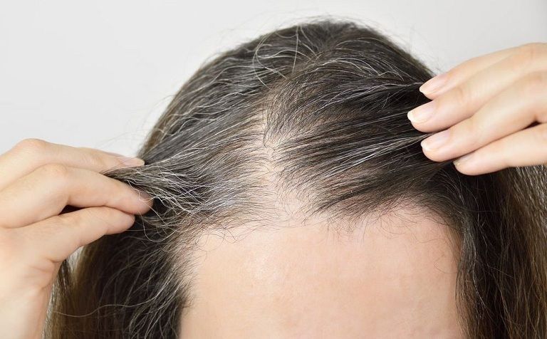 Tóc bạc sớm là thiếu chất gì?