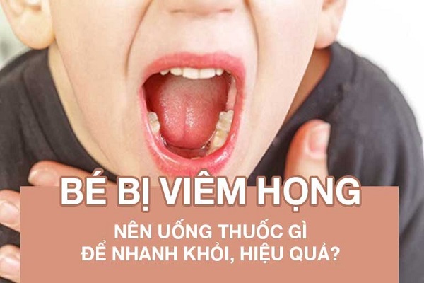 Bé bị viêm họng uống thuốc gì