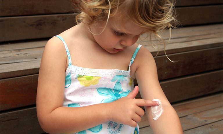 phòng ngừa chàm Eczema ở trẻ em