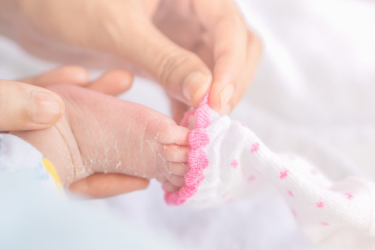 Chăm sóc trẻ bị chàm đỏ đúng cách sẽ giúp bệnh nhanh chóng được chữa khỏi.