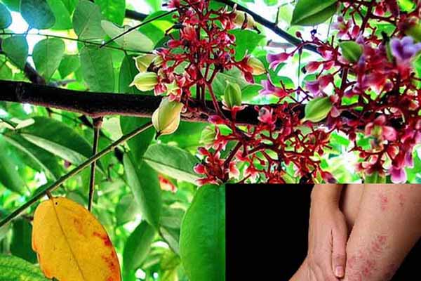 Chữa bệnh viêm da cơ địa bằng lá khế