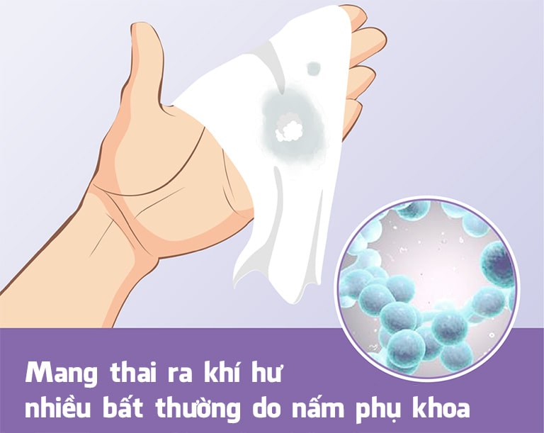 Ra nhiều khí hư bất thường kèm ngứa khó chịu là biểu hiện nhiễm nấm ở bà bầu