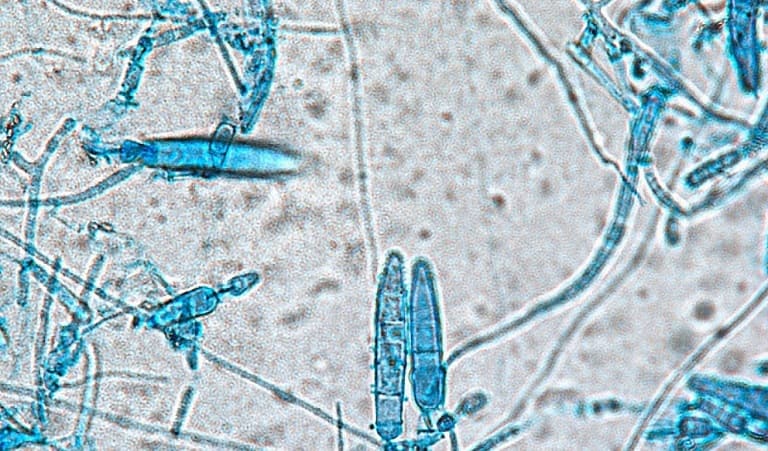 Hình ảnh dưới kính hiển vi của nấm Microsporum gây bệnh nấm da đầu.