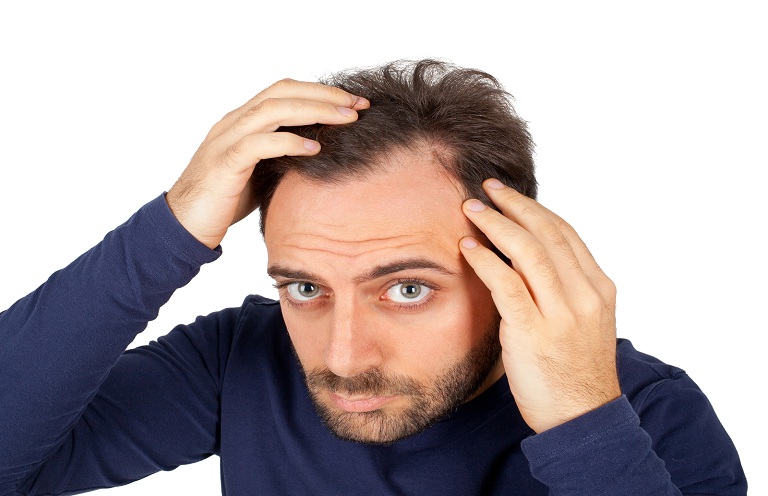 Nguyên nhân gây rụng tóc ở nam giới thường do di truyền
