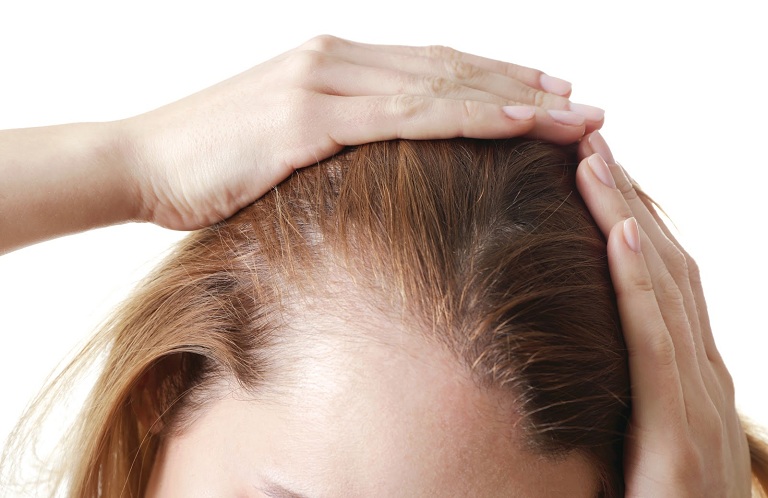 Nguyên nhân rụng tóc sau sinh do rối loạn nội tiết
