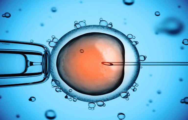 Phương pháp hỗ trợ sinh sản bằng cách bơm tinh trùng và tế bào tương trứng