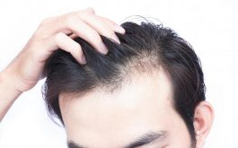 Nguyên nhân rụng tóc ở nam giới là gì?