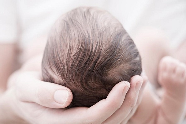 Rụng tóc vành khăn là gì và cách điều trị