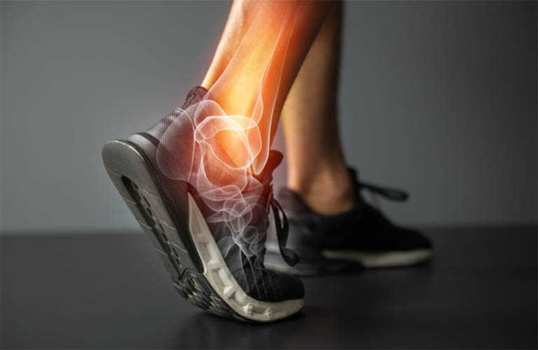 Thoái hóa khớp cổ chân: Nguyên nhân và hướng điều trị