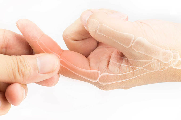 Bệnh thoái hóa khớp ngón tay: Nguyên nhân và cách phòng ngừa