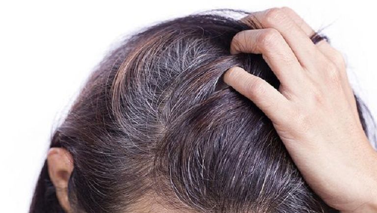 Người bị tóc bạc sớm thiếu chất gì? 