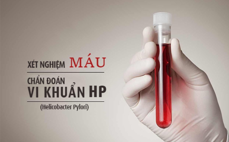 Xét nghiệm vi khuẩn HP nhanh chóng bằng máu