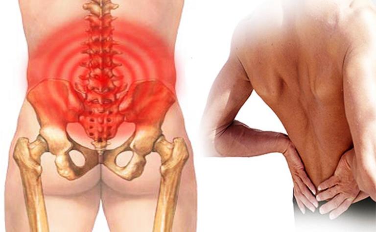 nguyên nhân đau thắt lưng trái ở nam giới 