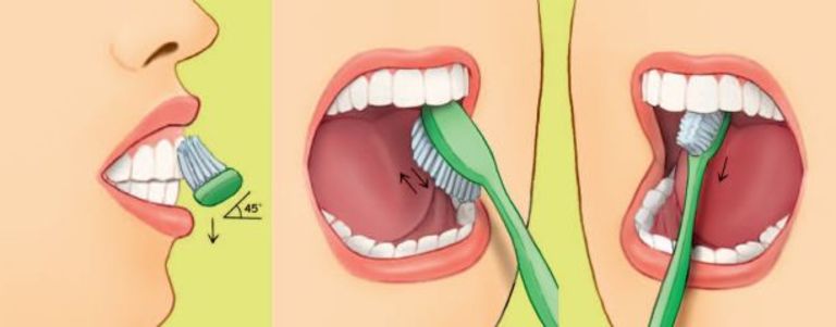 Vệ sinh răng miệng đúng cách là cách phòng và hỗ trợ chữa đau răng cơ bản, hiệu quả và an toàn.