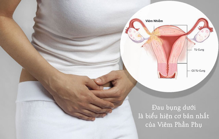 Dấu hiệu điển hình của bệnh viêm phần phụ