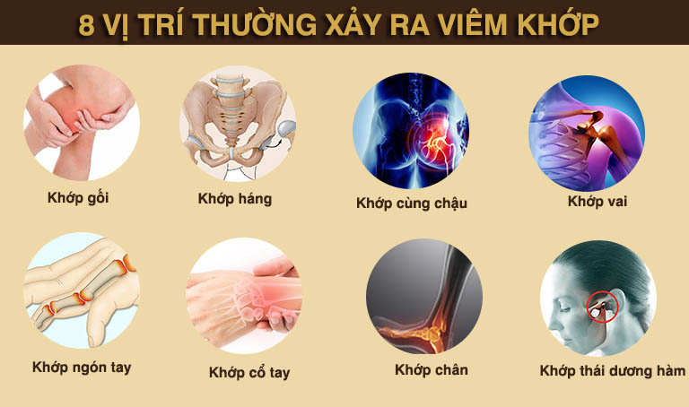 Các vị trí khớp thường bị viêm