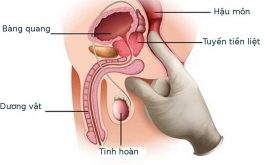 Mổ nội soi chỉ được chỉ định trong những trường hợp cụ thể