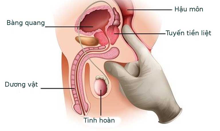 Mổ nội soi chỉ được chỉ định trong những trường hợp cụ thể