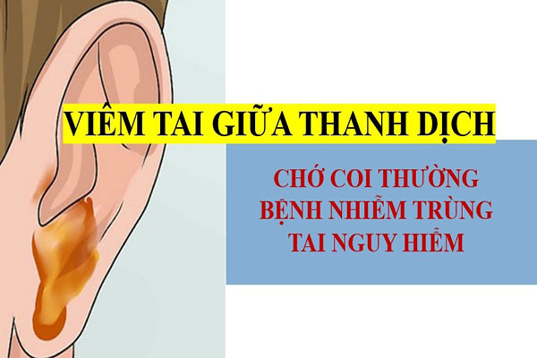 Viêm tai giữa thanh dịch
