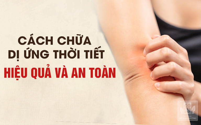 Cách chữa dị ứng thời tiết hiệu quả dứt điểm và an toàn