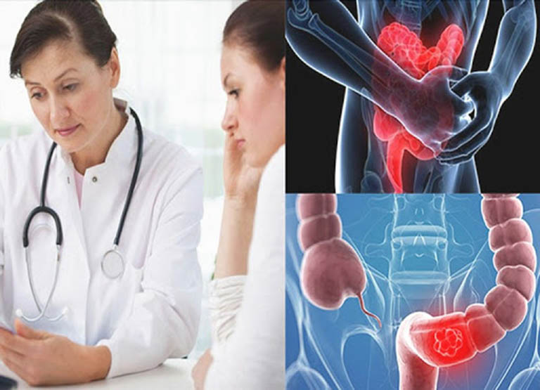 Hướng dẫn cách khám đại tràng hiệu quả