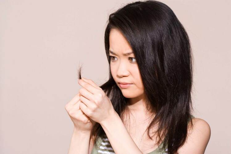 Rụng tóc ở nữ giới ngay từ khi dậy thì gây ra sự tự ti
